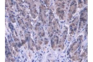 DAB staining on IHC-P; Samples: Rat Stomach Tissue (MRPL1 Antikörper  (AA 141-323))