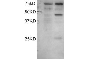 Image no. 1 for anti-Dyslexia Susceptibility 1 Candidate 1 (DYX1C1) (C-Term), (Isoform A) antibody (ABIN374525) (DYX1C1 Antikörper  (C-Term, Isoform A))