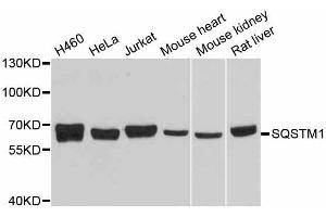 Western blot analysis of extracts of various cell lines, using SQSTM1 antibody. (SQSTM1 Antikörper  (AA 1-440))