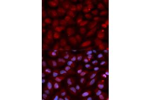 Immunofluorescence analysis of U2OS cell using CD47 antibody. (CD47 Antikörper)