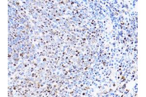 Immunohistochemistry of paraffin-embedded rat spleen using PCNA antibody (ABIN1874056) at dilution of 1:100 (40x lens). (PCNA Antikörper)