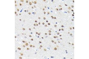 Immunohistochemistry of paraffin-embedded rat brain using Cullin 3 antibody (ABIN7266543) at dilution of 1:100 (40x lens).
