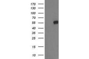 Western Blotting (WB) image for anti-Glucosidase, Beta, Acid 3 (Cytosolic) (GBA3) (AA 1-150), (AA 370-469) antibody (ABIN1490586) (GBA3 Antikörper  (AA 1-150, AA 370-469))