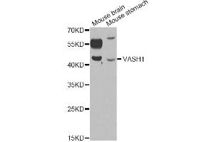Western blot analysis of extracts of various cell lines, using VASH1 antibody (ABIN6290544) at 1:1000 dilution.