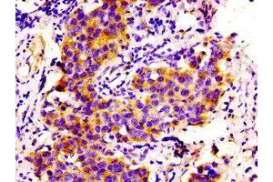 Immunohistochemistry (IHC) image for anti-Collagen, Type VI, alpha 2 (COL6A2) (AA 254-400) antibody (ABIN7148247)