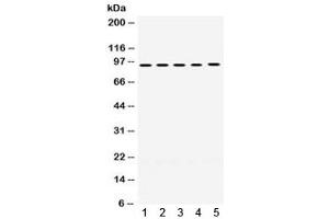 Western blot testing of human 1) A549, 2) SW620, 3) HeLa, 4) PANC, and 5) HepG2 lysate with MCM8 antibody. (MCM8 Antikörper)