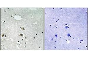 Immunohistochemistry analysis of paraffin-embedded human brain tissue, using S6 Ribosomal Protein (Ab-235/236) Antibody. (RPS6 Antikörper  (AA 200-249))