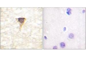 Immunohistochemistry analysis of paraffin-embedded human brain tissue, using CaMK4 (Ab-196/200) Antibody. (CAMK4 Antikörper  (AA 166-215))