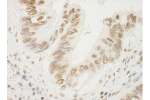 Immunohistochemistry (IHC) image for anti-Nucleophosmin (Nucleolar phosphoprotein B23, Numatrin) (NPM1) (AA 250-294) antibody (ABIN7448992)
