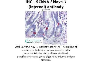 Image no. 1 for anti-Sodium Channel, Voltage-Gated, Type IX, alpha Subunit (SCN9A) (AA 460-510), (Internal Region) antibody (ABIN1739064) (SCN9A Antikörper  (Internal Region))