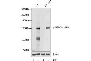 Western blot analysis of extracts of various cell lines, using Phospho-NEDD4L-S448 antibody (ABIN7266883) at 1:1000 dilution. (NEDD4-2 Antikörper  (pSer448))