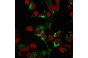 Immunofluorescence Analysis of PFA-fixed HepG2 cells labeling AFP using AFP Mouse Monoclonal Antibody (C2 + C3 + MBS-12) followed by Goat anti-Mouse IgG-CF488 (Green). (alpha Fetoprotein Antikörper)