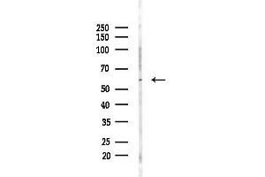 Western blot analysis of lysates from Mouse testis, using Phospho-Retinoic Acid Receptor alpha (Ser77) Antibody at 1/1000 dilution.