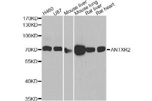 Western blot analysis of extracts of various cell lines, using ANTXR2 antibody (ABIN5975032) at 1/1000 dilution. (ANTXR2 Antikörper)