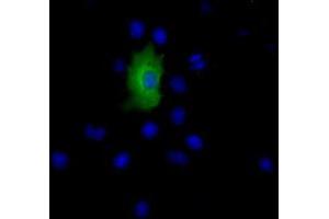Anti-EPHX2 mouse monoclonal antibody (ABIN2452988) immunofluorescent staining of COS7 cells transiently transfected by pCMV6-ENTRY EPHX2 (RC202489). (EPHX2 Antikörper)