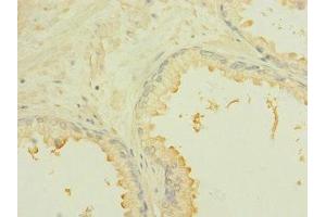 Immunohistochemistry (IHC) image for anti-Roundabout, Axon Guidance Receptor, Homolog 2 (ROBO2) (AA 450-660) antibody (ABIN7168444)