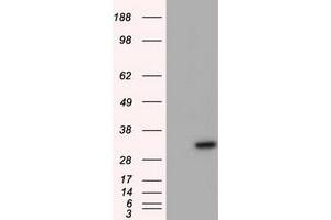 Western Blotting (WB) image for anti-Nitrilase Family, Member 2 (NIT2) antibody (ABIN1499740) (NIT2 Antikörper)