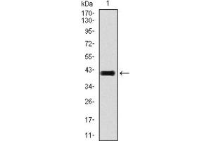 Western blot analysis using TGFb1 antibody against human TGFb1 recombinant protein. (TGFB1 Antikörper  (AA 62-195))