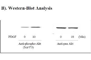 Image no. 3 for V-Akt Murine Thymoma Viral Oncogene Homolog 1 (AKT1) ELISA Kit (ABIN625220)