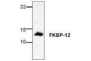 Image no. 1 for anti-FK506 Binding Protein 1A, 12kDa (FKBP1A) antibody (ABIN127265) (FKBP1A Antikörper)