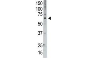 Western Blotting (WB) image for anti-Melanoma Antigen Family D, 2 (MAGED2) antibody (ABIN3002534) (MAGED2 Antikörper)