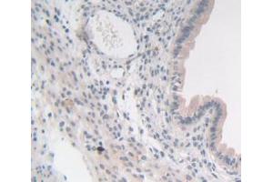 IHC-P analysis of Mouse Uterus Tissue, with DAB staining. (SYN1 Antikörper  (AA 113-420))