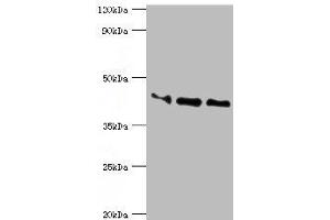 Western blot All lanes: Apolipoprotein L1 antibody at 10 μg/mL Lane 1: A549 whole cell lysate Lane 2: Hela whole cell lysate Lane 3: HepG2 whole cell lysate Secondary Goat polyclonal to rabbit IgG at 1/10000 dilution Predicted band size: 44, 46, 43 kDa Observed band size: 44 kDa (APOL1 Antikörper  (AA 179-398))