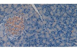 Immunohistochemistry (IHC) image for anti-Matrix Metallopeptidase 3 (Stromelysin 1, Progelatinase) (MMP3) (AA 278-450) antibody (ABIN7431008)