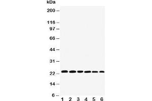 Western blot testing of SNAP23 antibody and Lane 1:  rat spleen;  2: (r) testis;  3: (r) ovary;  4: human HeLa;  5: (h) MCF-7;  6: (h) SKOV;  Expected size: ~23KD (SNAP23 Antikörper  (C-Term))