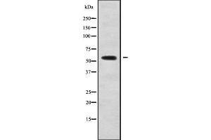 Western blot analysis of CALCRL using 293 whole cell lysates (CALCRL Antikörper  (C-Term))