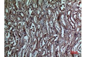 Immunohistochemistry (IHC) analysis of paraffin-embedded Human Kidney, antibody was diluted at 1:100. (BNIP3 Antikörper  (Internal Region))