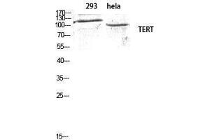 Western Blotting (WB) image for anti-Telomerase Reverse Transcriptase (TERT) (Tyr1510) antibody (ABIN3177676) (TERT Antikörper  (Tyr1510))