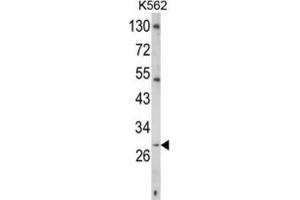 Western Blotting (WB) image for anti-CD40 Ligand (CD40LG) antibody (ABIN3002678) (CD40 Ligand Antikörper)
