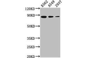 Western Blot Positive WB detected in: K562 whole cell lysate, A549 whole cell lysate, 293T whole cell lysate All lanes: XRCC5 antibody at 1:2000 Secondary Goat polyclonal to rabbit IgG at 1/50000 dilution Predicted band size: 83 kDa Observed band size: 83 kDa (Rekombinanter XRCC5 Antikörper)