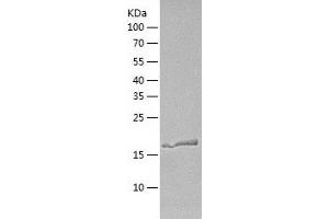 Western Blotting (WB) image for Calcineurin B (CAN) (AA 1-173) protein (His tag) (ABIN7122079) (Calcineurin B Protein (CAN) (AA 1-173) (His tag))