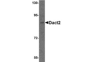 Western Blotting (WB) image for anti-Dapper, Antagonist of beta-Catenin 2 (DACT2) (N-Term) antibody (ABIN1031341) (DACT2 Antikörper  (N-Term))