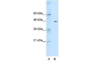 Western Blot showing GDI2 antibody used at a concentration of 1-2 ug/ml to detect its target protein. (GDI2 Antikörper  (C-Term))