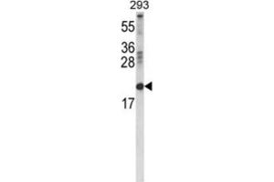 Western Blotting (WB) image for anti-Retinol Binding Protein 2, Cellular (RBP2) antibody (ABIN3004227) (RBP2 Antikörper)