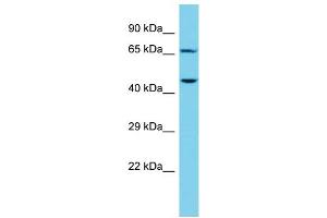 Host: Rabbit Target Name: CTTNBP2NL Sample Type: NCI-H226 Whole Cell lysates Antibody Dilution: 1. (CTTNBP2NL Antikörper  (N-Term))