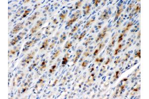 Immunohistochemistry (IHC) image for anti-Chaperonin Containing TCP1, Subunit 2 (Beta) (CCT2) (AA 414-535) antibody (ABIN4886512)