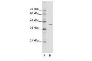Image no. 1 for anti-Zinc Finger and BTB Domain Containing 26 (ZBTB26) (AA 181-230) antibody (ABIN6736113) (ZBTB26 Antikörper  (AA 181-230))