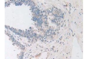 Immunohistochemistry (IHC) image for anti-Coagulation Factor VIII (F8) (AA 1887-2044) antibody (ABIN7438070)