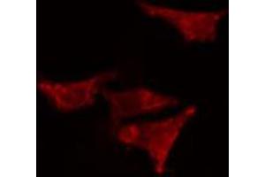 ABIN6266802 staining HeLa cells by IF/ICC. (EPS8-Like 2 Antikörper  (N-Term))