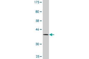 Western Blot detection against Immunogen (36. (DOCK4 Antikörper  (AA 1867-1966))