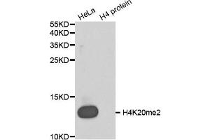 Western blot analysis of extracts of various cell lines, using Dimethyl-Histone H4-K20 antibody (ABIN5969818).