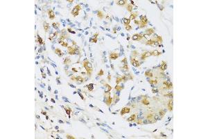 Immunohistochemistry of paraffin-embedded human stomach using RNASE3 antibody (ABIN5974969) at dilution of 1/100 (40x lens).