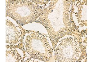 ABIN6265644 and ABIN6266780 at 1/100 staining Rat testis tissue by IHC-P.