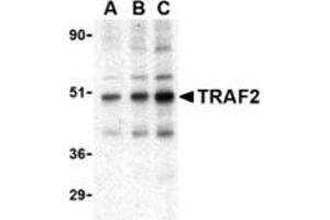 Western blot analysis of TRAF2 in mouse liver tissue lysate with this product at (A) 0. (TRAF2 Antikörper  (C-Term))