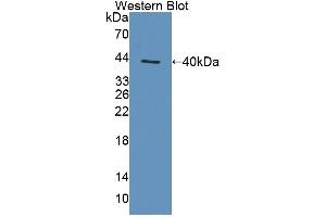 Western blot analysis of the recombinant protein. (TAP1 Antikörper  (AA 525-808))