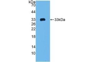 Detection of Recombinant COL1a2, Mouse using Polyclonal Antibody to Collagen Type I Alpha 2 (COL1a2) (COL1A2 Antikörper  (AA 1109-1372))